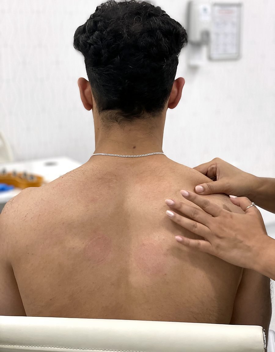 Hands-on assessment of the upper back and shoulder blade at Somatic Recovery in Dubai